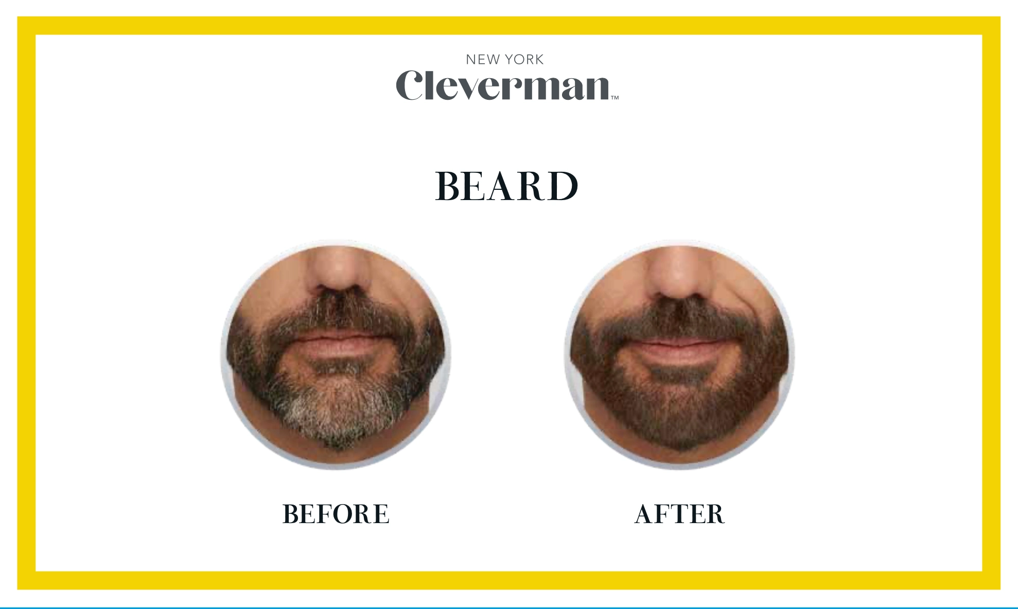 cover beard